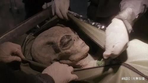 解剖吃瓜事件图片,揭秘人体器官的奇妙之旅